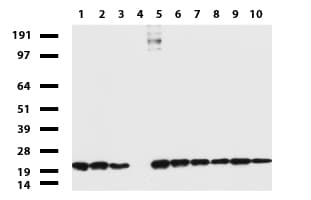 Monoclonal Mouse anti-Human NME1 / NM23 Antibody (clone UMAB94, Carrier-free, IHC, IF, WB)