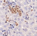 MAP1LC3A / LC3A Antibody (N-Terminus)