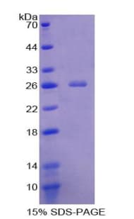 Human VWA3A Protein (Recombinant His-T7)