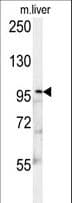 Polyclonal Rabbit anti-Human KIF9 Antibody (aa581-609, IHC, WB)