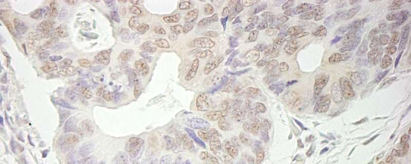 Polyclonal Rabbit anti-Human Trimethylguanosine Synthase 1 Antibody (aa150-200, IHC)