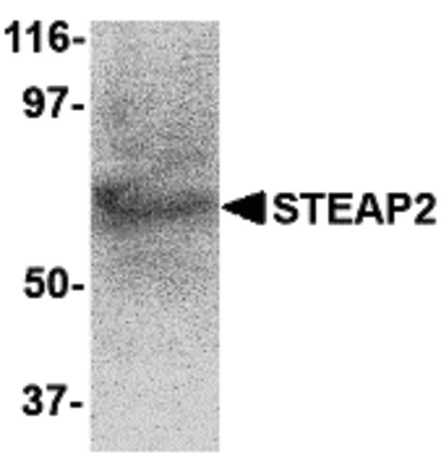IHC-plus™ STEAP2 Antibody