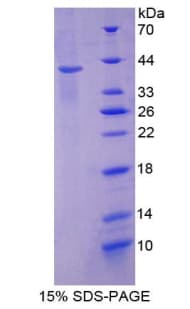 Mouse KRT2 / CK2 / Cytokeratin 2 Protein (Recombinant His-T7)