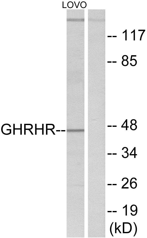 GHRHR Antibody