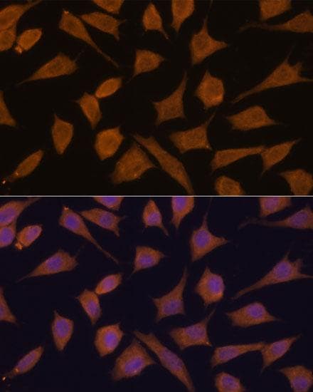 SEPT3 / Septin 3 Antibody
