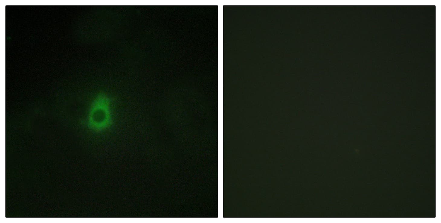 IHC-plus™ CYP2E1 Antibody (aa371-420)