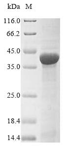 Neisseria meningitidis tbp1 Protein (Recombinant 10His, N-terminus + Myc, C-terminus)