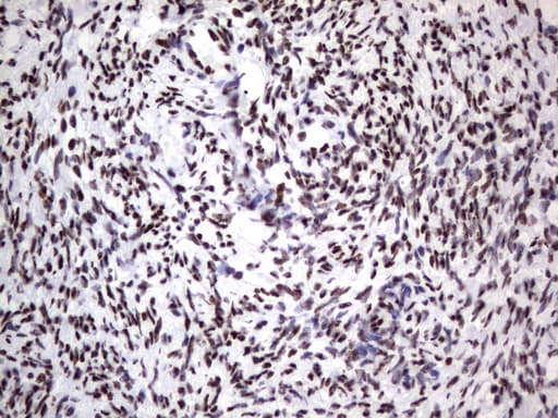 DDX56 Antibody (aa323-547, clone UMAB153)