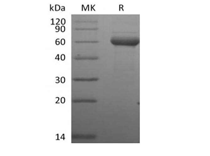 Human BTN3A1 / CD277 Protein (Recombinant Fc-AVI, C-terminus)