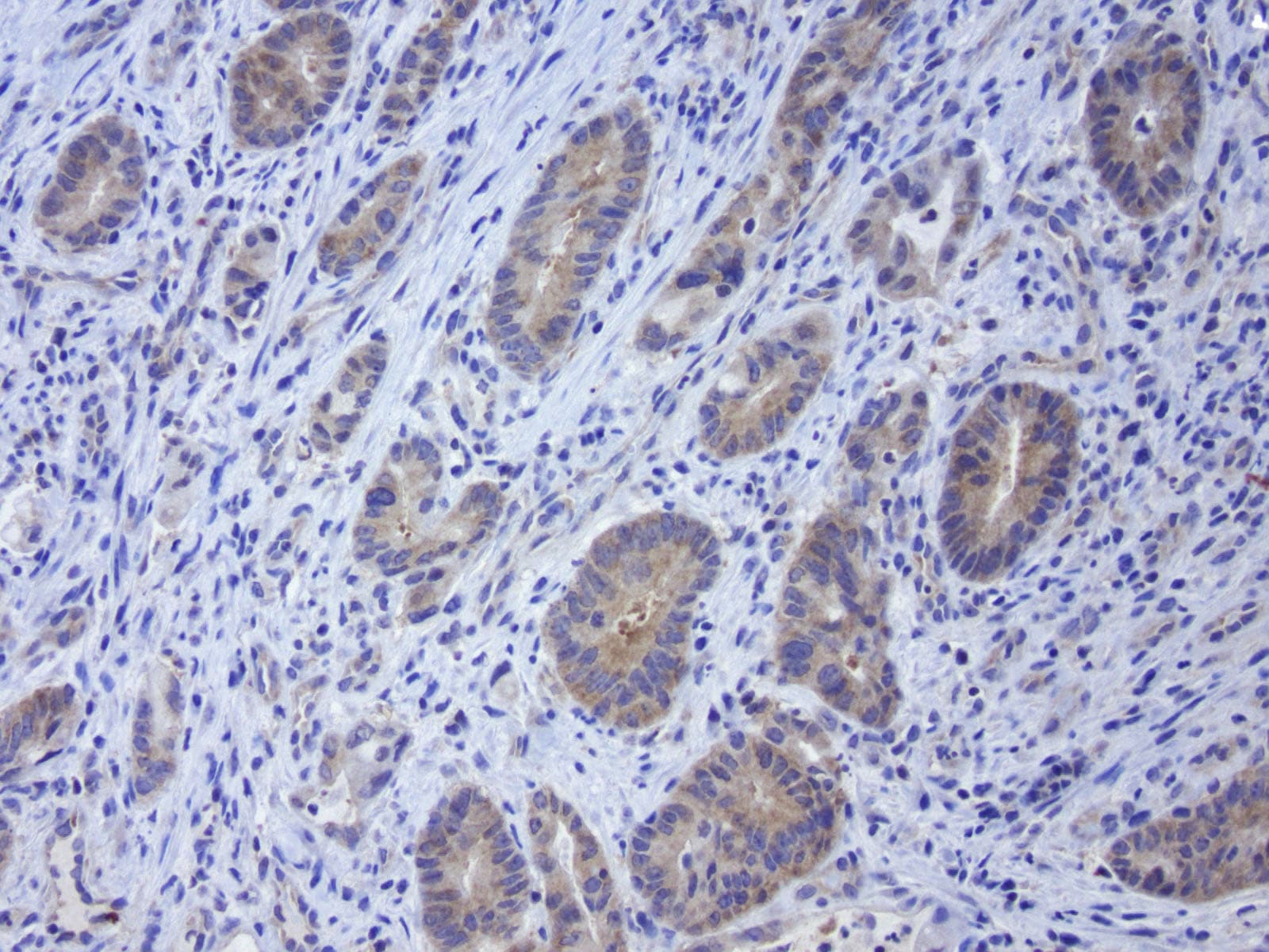 GPR49 / LGR5 Antibody (aa22-543, clone UMAB211)