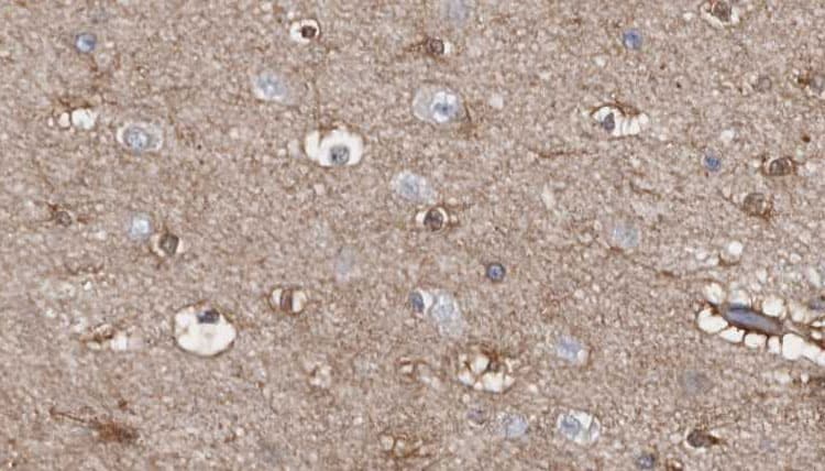 TNIP3 Antibody