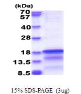 Hepatitis C Virus HCV Core Protein (Recombinant His)