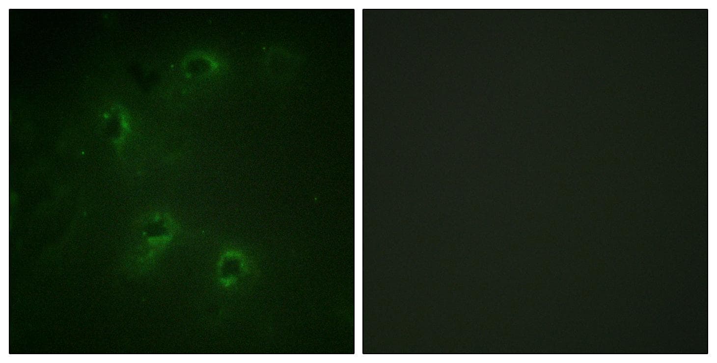 Polyclonal Rabbit anti-Human DAPK1 / DAP Kinase Antibody (Ab-308, IHC, IF)