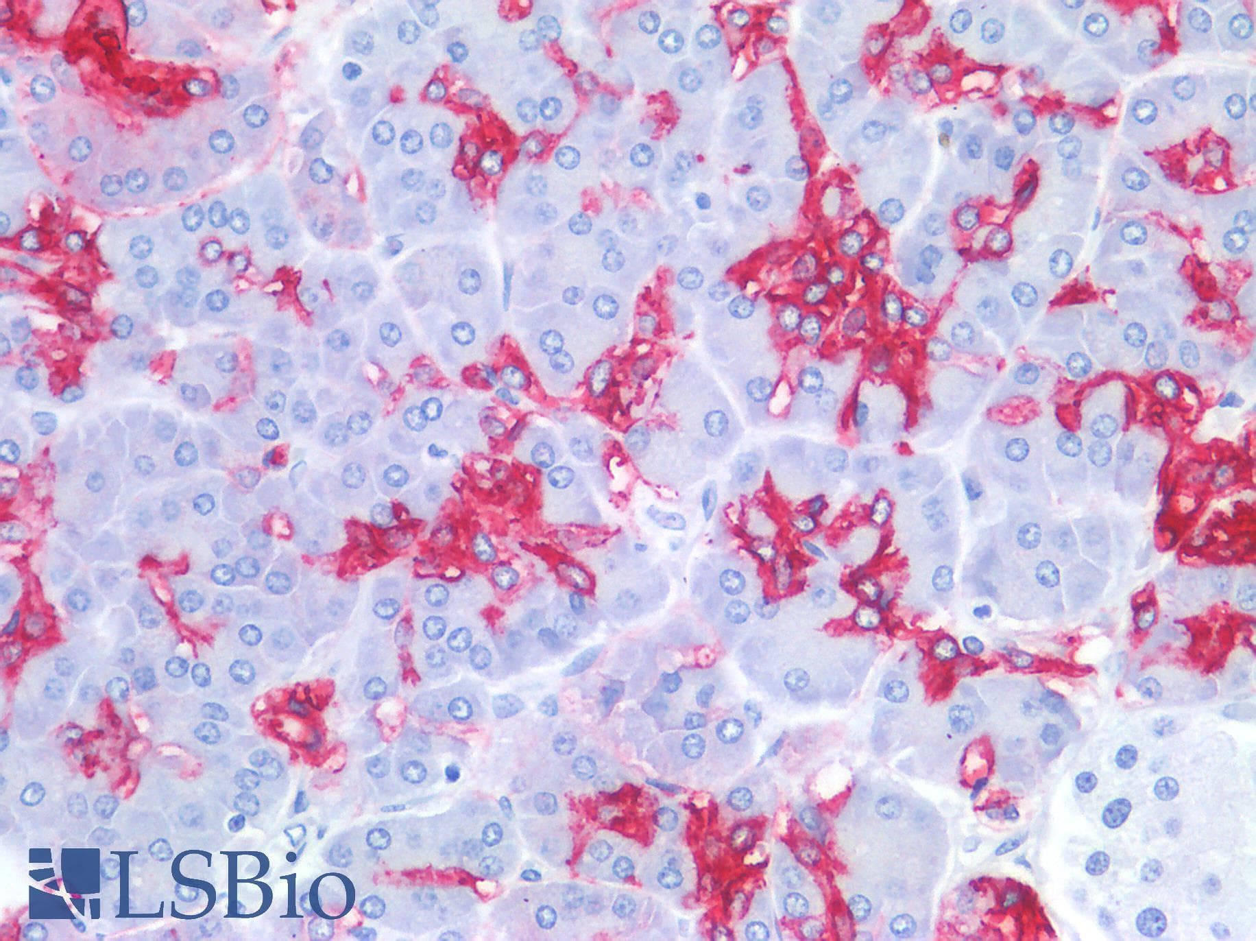 IHC-plus™ Sialylated Lewis a / CA 19-9 Antibody (clone SPM588, Azide-free, BSA-free)