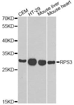 RPS3 / Ribosomal Protein S3 Antibody