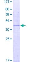 Human CENPW / C6orf173 Protein (Recombinant GST)