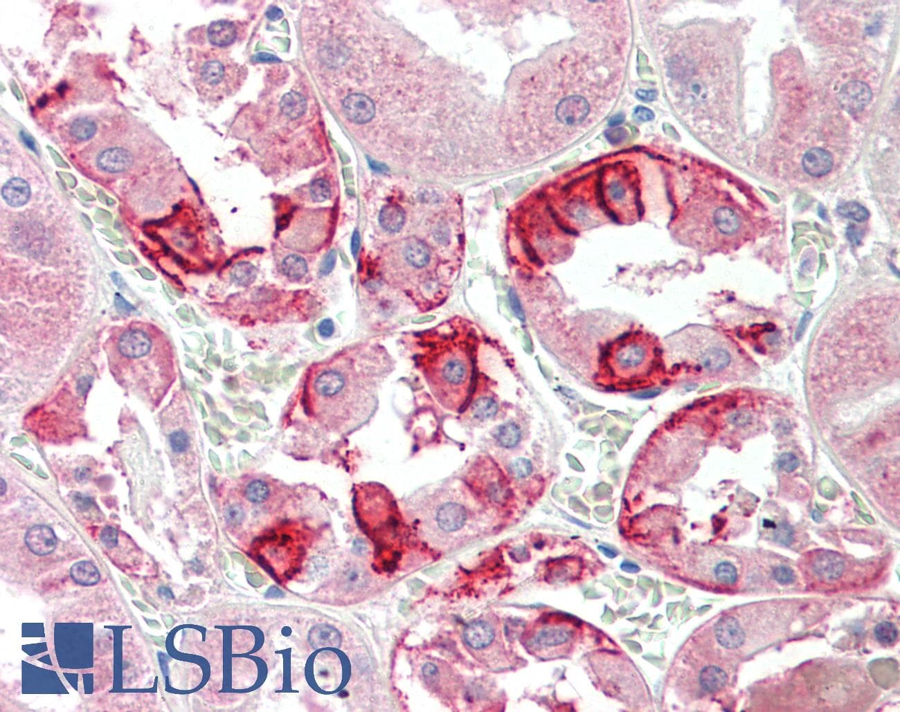 IHC-plus™ CA12 / Carbonic Anhydrase XII Antibody (aa188-199)