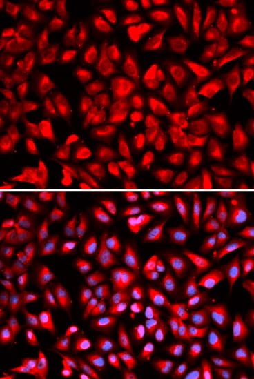 IPO5 / RANBP5 Antibody