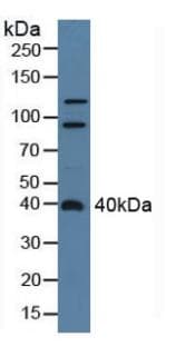 ADAP2 / CENTA2 Antibody (aa49-360, Biotin)