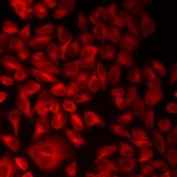 ALS2 / Alsin Antibody