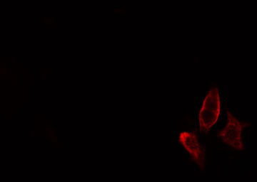 Polyclonal Rabbit anti-Human LIPE / HSL Antibody (phospho-Ser855,phospho-Ser554, IHC, IF, WB)