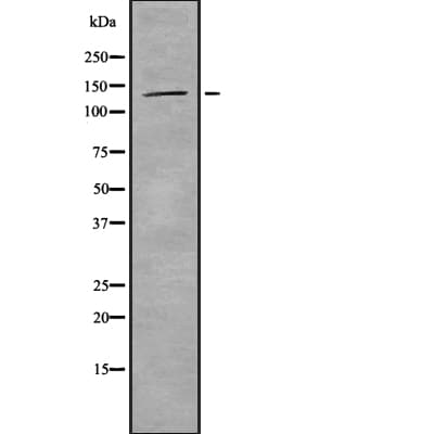 TIMELESS Antibody