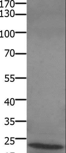 STMN2 + STMN3 + STMN4 Antibody