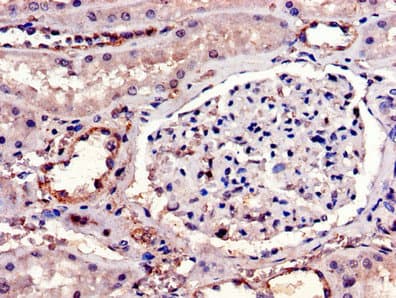 IL23R Antibody