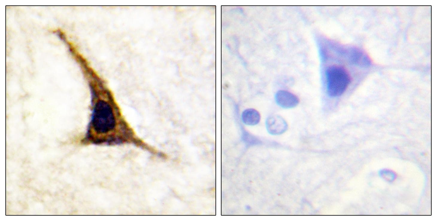 ADRB2 Antibody (phospho-Ser355+Ser356)