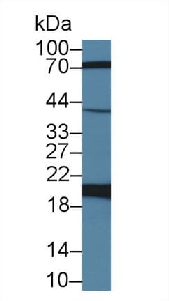FTH1 / Ferritin Heavy Chain Antibody (aa1-171)