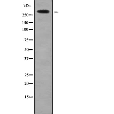 HECTD1 Antibody