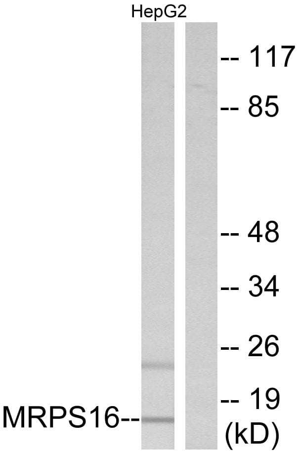 Polyclonal Rabbit anti-Human MRPS16 Antibody (IHC, WB)