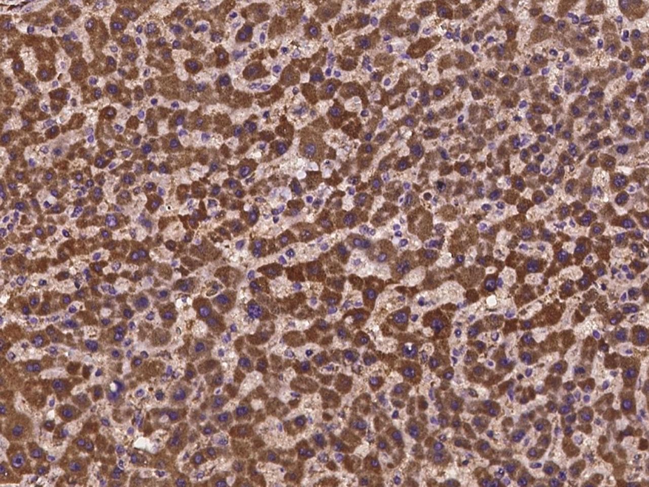 HOGA1 Antibody