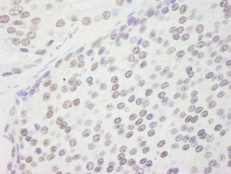 Polyclonal Rabbit anti-Human CPSF160 / CPSF1 Antibody (aa1392-1442, IHC, IF)