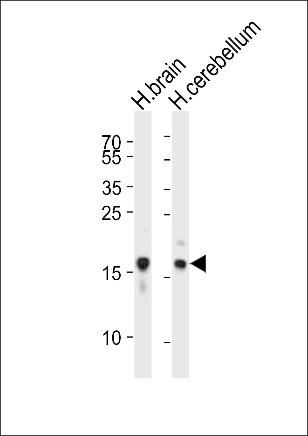 SNCA / Alpha-Synuclein Antibody (aa92-125)