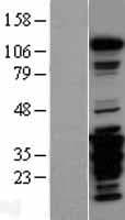 FAK / Focal Adhesion Kinase Protein (Over-Expression Lysate Myc-DDK (Flag))