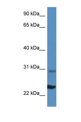 RPL17 / Ribosomal Protein L17 Antibody (N-Terminus)