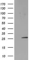 SSX1 Antibody (clone OTI1D10)