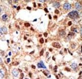 PML Antibody (aa470-499)