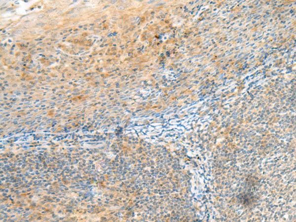 Polyclonal Rabbit anti-Human CLEC3B / Tetranectin Antibody (IHC, WB)