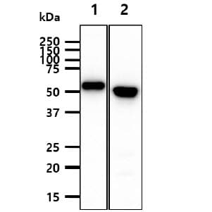 KRT20 / CK20 / Cytokeratin 20 Antibody (clone AT10D8)