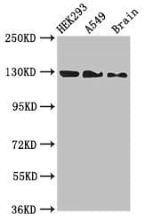 EIF4ENIF1 / 4E-T Antibody