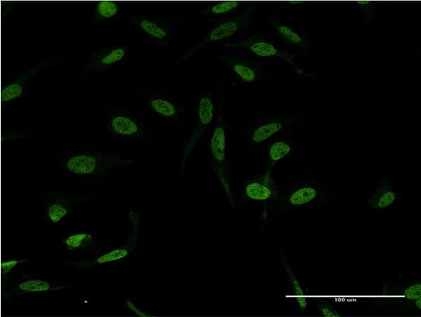 Monoclonal Mouse anti-Human XPA Antibody (clone 2E4, IF, WB)