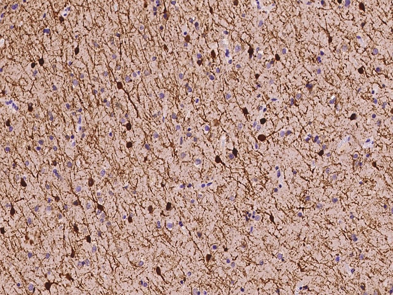 CALB2 / Calretinin Antibody