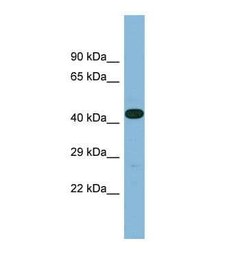 LRRC49 Antibody (aa264-313)