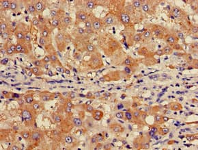 Polyclonal Rabbit anti-Human GABARAPL1 / ATG8 Antibody (IHC, IF)