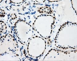 RIP1 / RALBP1 Antibody (clone OTI6C6)