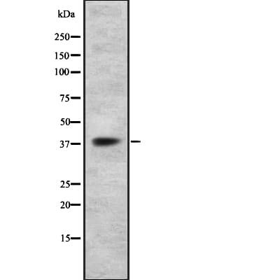 P2RY14 / GPR105 Antibody