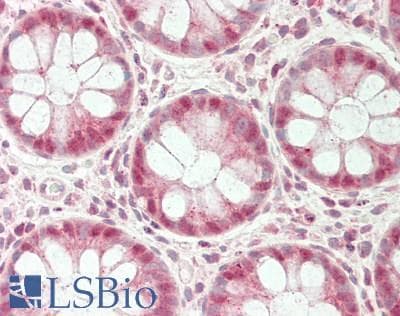 Polyclonal Rabbit anti-Human UCHL3 Antibody (C-Terminus, IHC, WB)