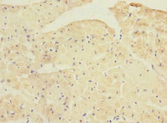 PPP1R3A / GM Antibody